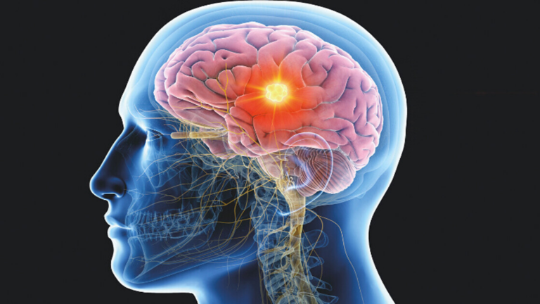 Pain, Effort, and the aMCC: The Science Behind Mental Toughness